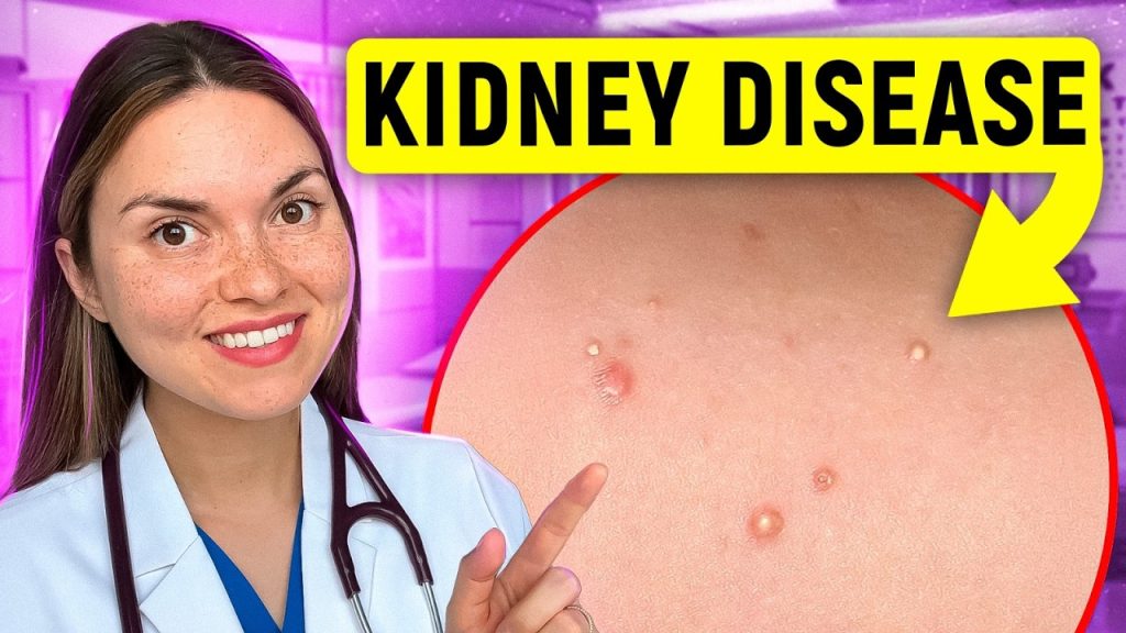 17 Signs of KIDNEY DISEASE You Can See: Doctor Explains