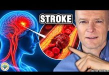 #1 Best Way To Prevent A Stroke #1 Best Way To Prevent A Stroke